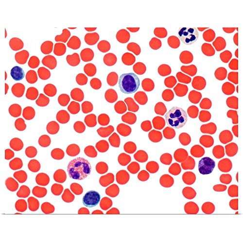 GREATBIGCANVAS Blood Smear Unframed Poster Print