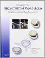 Carpentier&#39;s Reconstructive Valve Surgery， 1e Carpentier's Reconstructive Valve Surgery - 1st Edition