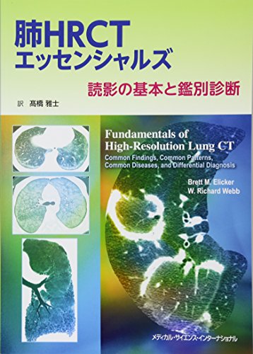 スマホ 無料電子書籍 肺HRCTエッセンシャルズ 読影の基本と鑑別診断 バイ