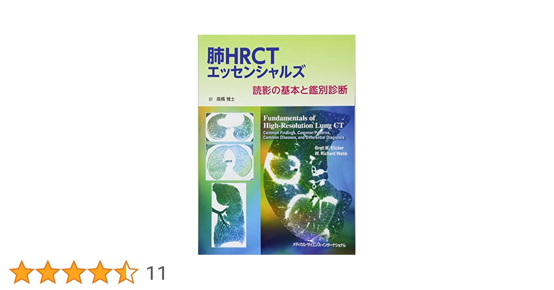 肺HRCTエッセンシャルズ 読影の基本と鑑別診断 | 高橋雅士 |本