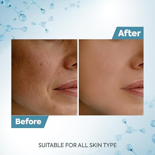 Miniatura 7 de Crema de eliminación De-Tan Tan 2.54 oz (12g6)