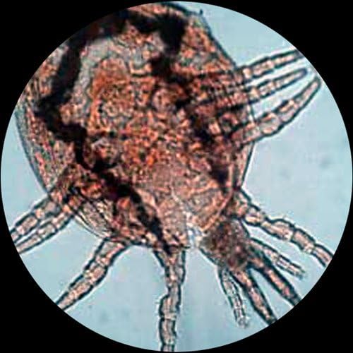 AmScope IN400T-5M Digital Long Working-Distance Inverted Trinocular Microscope, 40x-600x, WH10x Super-Widefield Eyepieces, Brightfield and Phase-Contrast Objectives, 30W Halogen Illumination, 0.3 NA Abbe Condenser, Plain Stage, 90 to 240V, Includes 5MP Camera with Reduction Lens and Software