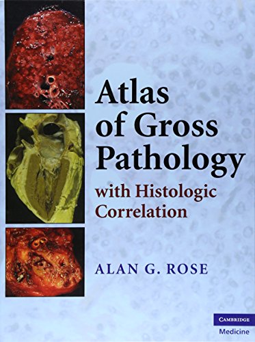 Atlas of Gross Pathology: With Histologic Correlation