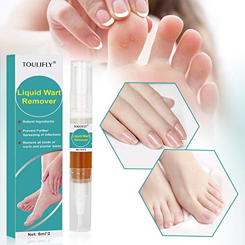 Wart Remover,Foot Wart Remover,Plantar Wart Remover,Wart Remover Liquid Pen Corn Callus Remover Liquid for Common Warts Plantar Corn Callus Stops Wart Regrowth