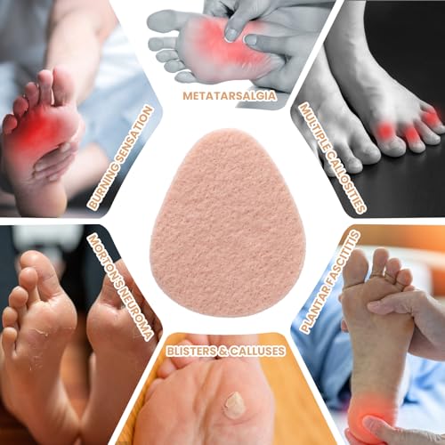 Image of Dimeho 30PCS Metatarsal Felt Foot Pad Foot Metatarsal Pads for Women Men Adhesive Forefoot Pads Forefoot Cushion Pads Ball of Foot Cushion Pain Relief Forefoot Sole Support Foam Foot Cushion Pad
