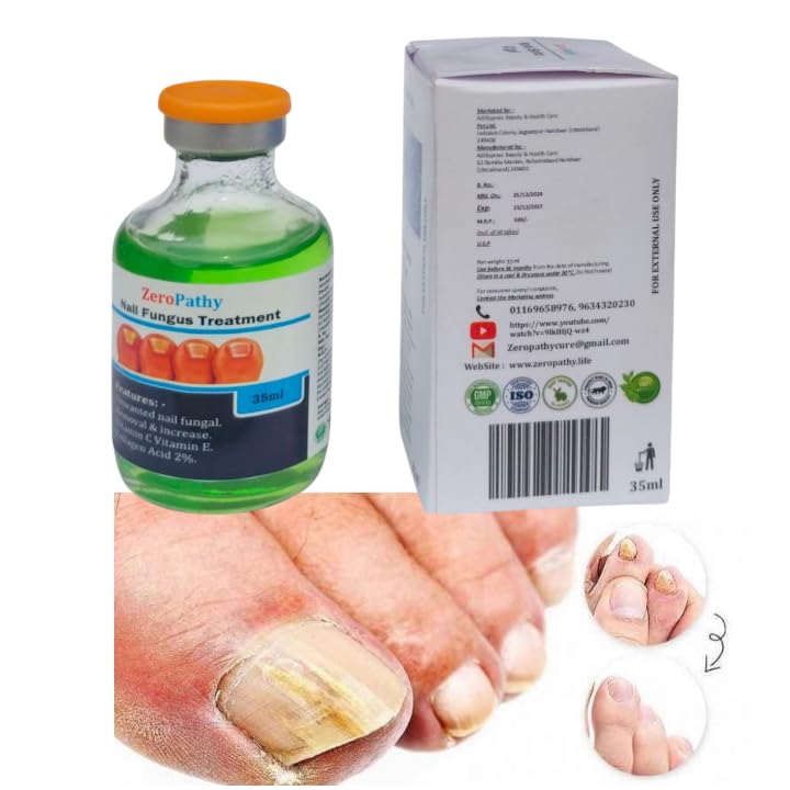 Image of Herbal Nail Treatment Lotion for Dry, Fungal, and Broken Nails | Encourages Healthy Nail Growth with Ayurvedic Power | Soothes Nail Beds, Repairs Texture, and Prevents Nail Lifting and Cracking