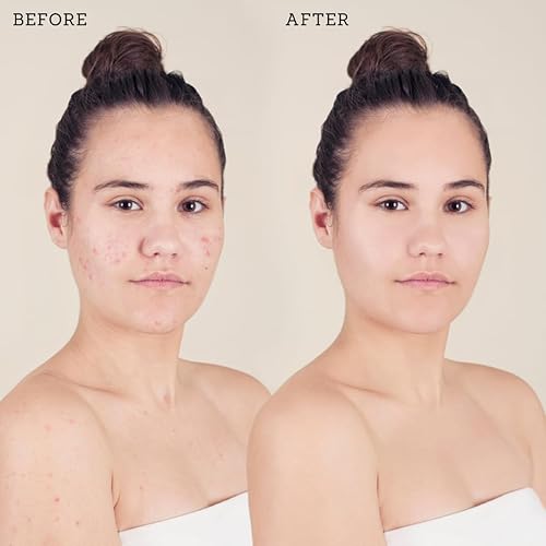 Miniatura 8 de Jupiters Bloom - Almohadillas de ácido kójico de cúrcuma para cara y cuerpo con pantenol vitamina B5, desvanece las manchas oscuras, exfolia la piel