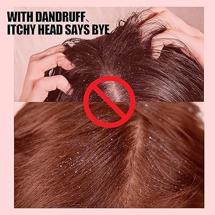 Sulfur Medicated Anti-Dandruff Conditioner for Braids 356 ml, White, 356 ml (Pack of 1) - Image 3