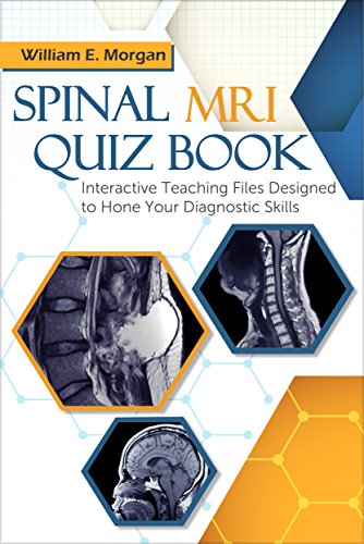 Spinal MRI Quiz Book: Interactive Teaching Files Designed to Hone Your Diagnostic Skills (English Edition) Spinal MRI Quiz Book: Interactive Teaching Files Designed to Hone Your Diagnostic Skills (English Edition)