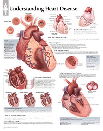 Understanding Heart Disease chart: Laminated Wall Chart