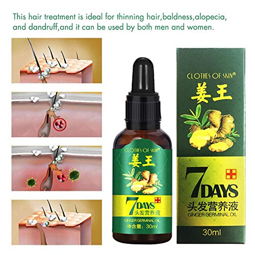 Haar Wachstum Serum,Haar serum, Haarausfall und Haar-Behandlung, Neues Haarwachstum stimuliert (30ml) – Bild 3