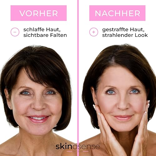 Skinosense® Eye Pads, 10 Paar Anti-Aging Augenpads, mit Hyaluronsäure & Kollagen, reduziert Augenringe & feine Linien, feuchtigkeitsspendend für strahlende Augen, für alle Hauttypen