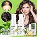 Produktbild Perfectly Hair Growth Ginger Oil, Ginger Growth Anti-Haarausfall-Spray, Boost-Haarwachstum-Ingwer-Spray, Haar-aktives Root-Boost-Ingwer-Spray, Nachwachsendes nährendes Ingwer-Spray (4 Stück)