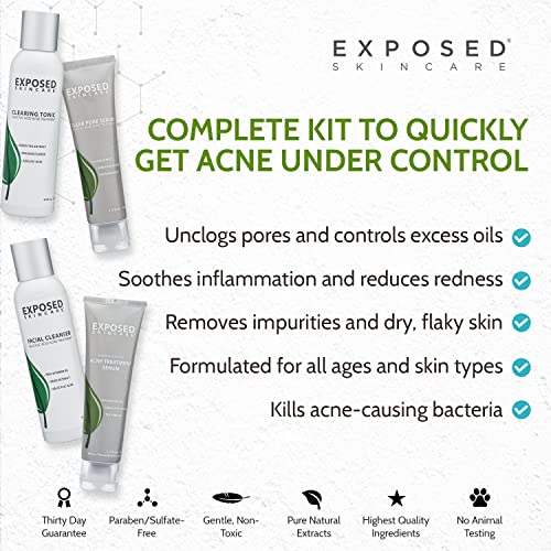 Exposed Skin Care Basic Acne Treatment Kit Includes Salicylic Acid