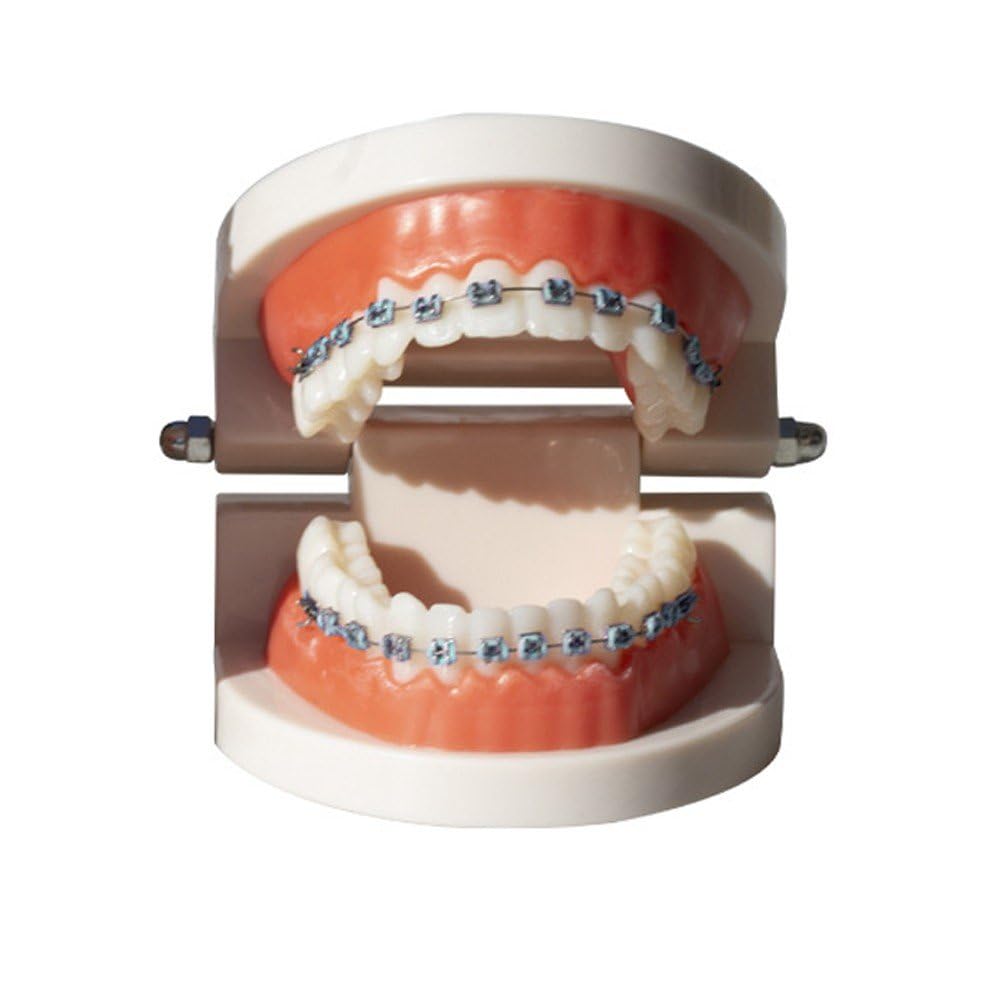 Soporte Dental Metal Azul, Gancho Decoración Temporal Dientes con Alambres Ligaduras Ortodoncia