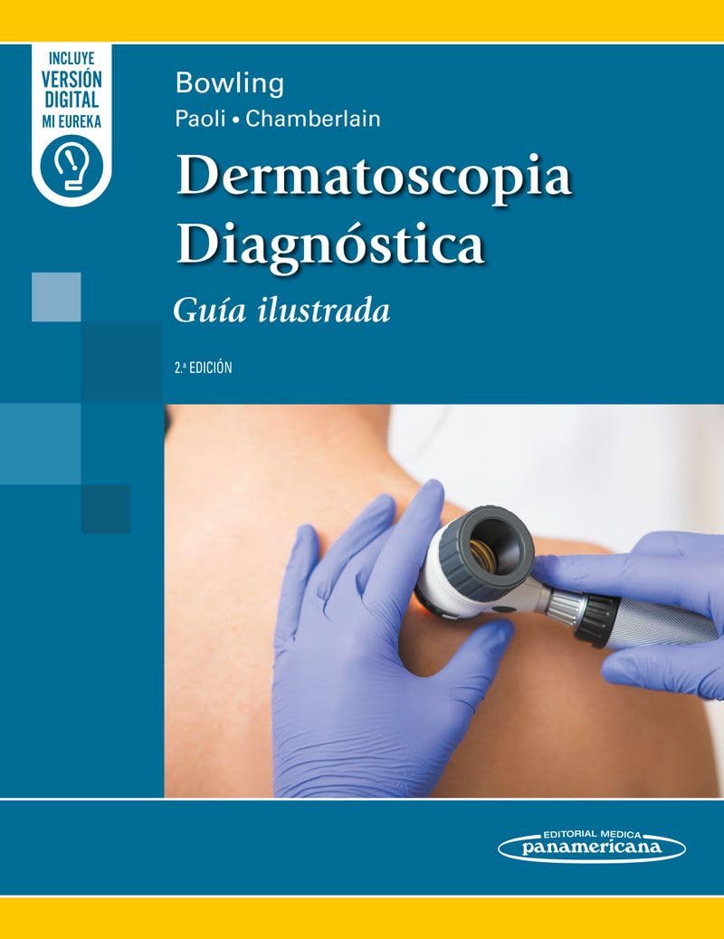 Dermatoscopia Diagnóstica: Guía Ilustrada