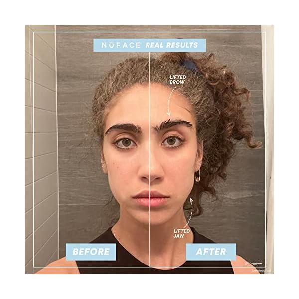 NuFACE Trinity Starter Kit Microcurrent Facial Toning Device with Hydrating LeaveOn Gel