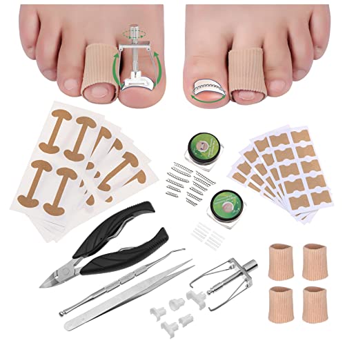 Top 10 Tweezers For Ingrown Toenails of 2022 Katynel