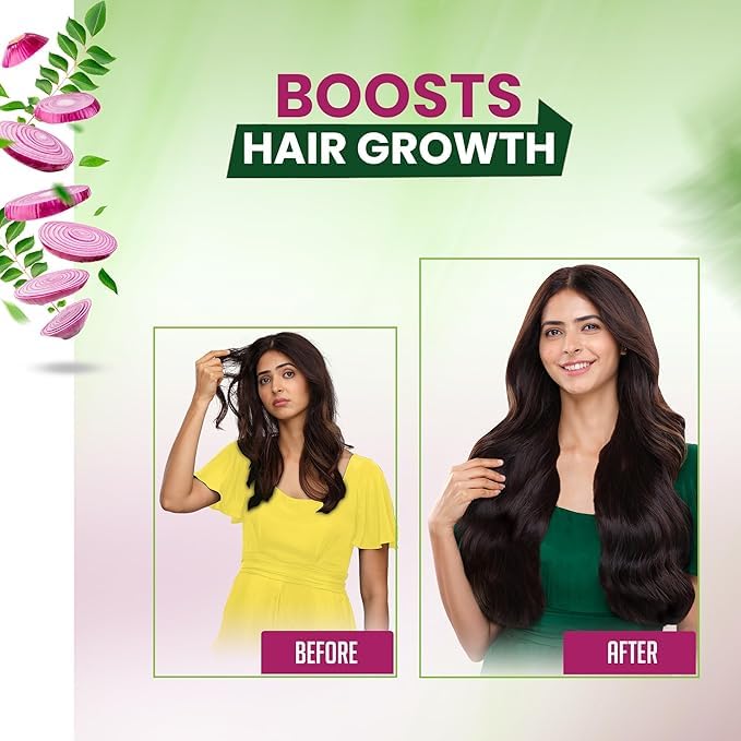 Image of Kesh King Onion Oil With Curry Leaves Reduces Hair Fall 100ml