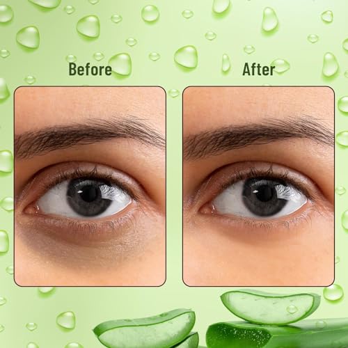 Image of Hydra Under Eye Peach & Vitamin C Serum Patches. Under Eye Masks to Reduce Dark Circles, Puffiness Fine Lines & Wrinkles. Pack of 60 Patches (30 pairs) [ALOEVERA]