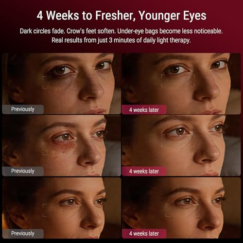 Image of Red Light Therapy Mask - Red Light Therapy for Eyes with 3-Minute, 4 Wavelengths, Targets Wrinkles, Fine Lines, Dark Circles & Eye Bags, Women Men for Home & Travel (Pink)