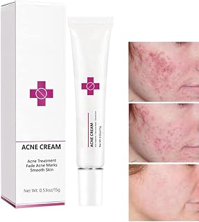 OnkessyBeauty Acne Cream: Fast Pimple Remover & Oil Control for Oily Acne-Prone Skin, Cruelty-Free Face Treatment