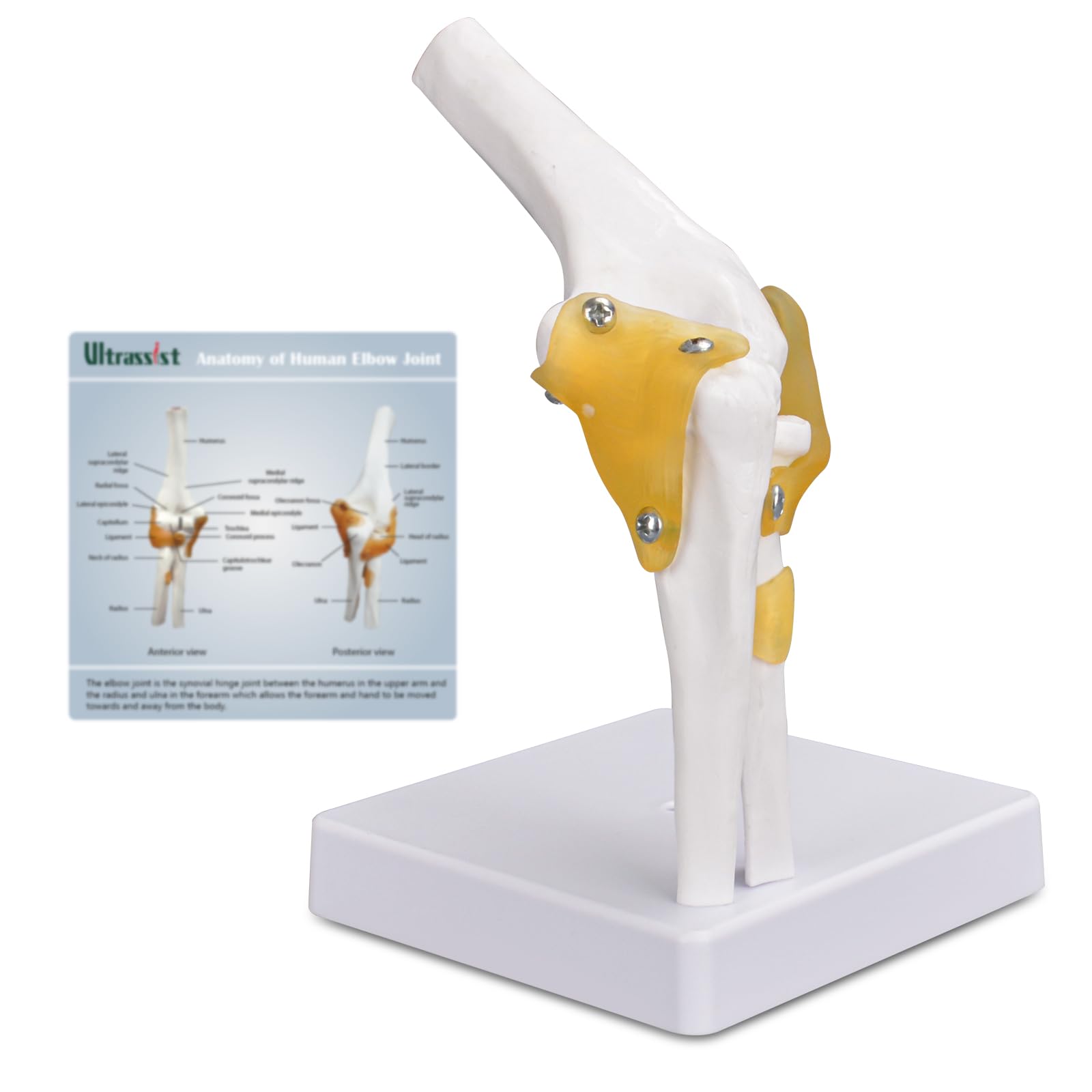 Ultrassist Human Elbow Joint Model with Ligaments, Flexible Knee Joint Model, Human Knee Joint Anatomy Model, Best Teaching Tool for Patient Education & Anatomy Study