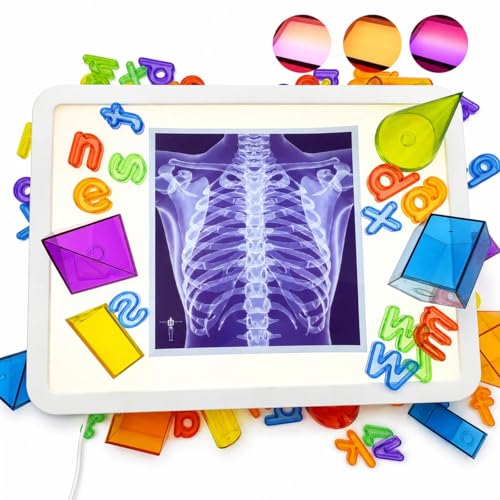 LED Light Up Table for Kids Shine Bright Light Box with 10 Levels & 3 Color Modes Portable Dimmable Box for Tracing Magna-Tiles Art & Education Fits IKEA Flisat Table Home & Classroom(16 Blue)