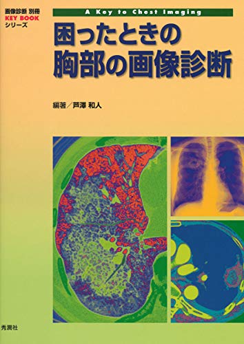 無料電子書籍 アプリ 困ったときの胸部の画像診断 (画像診断別冊KEY BOOKシリーズ) バイ