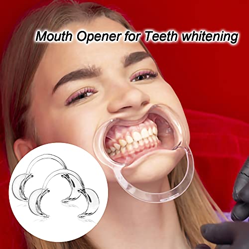 30-Pack Dental Cheek Retractor, Professional Autoclavable Mouth Opener Retractors, 100% Bpa-Free, For Dentist, Teeth Whitening, Party, Mouthguard Challenge Game - Size M, Clear #TOP5