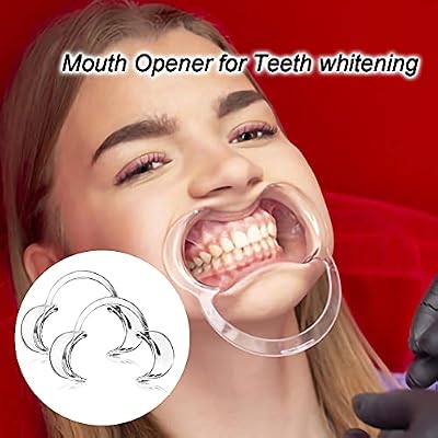 30-Pack Dental Cheek Retractor, Professional Autoclavable Mouth Opener Retractors, 100% BPA-Free, for Dentist, Teeth Whitening, Party, Mouthguard Challenge Game - Size M, Clear