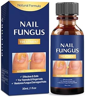 Toenail fungus treatment, Nail Fungus Treatment for Toenail, Toe Nail Fungus Treatment Extra Strength Effective Fingernail and Toenail Fungus Killer,Nail Repair Solution, Restoring Healthy Nails