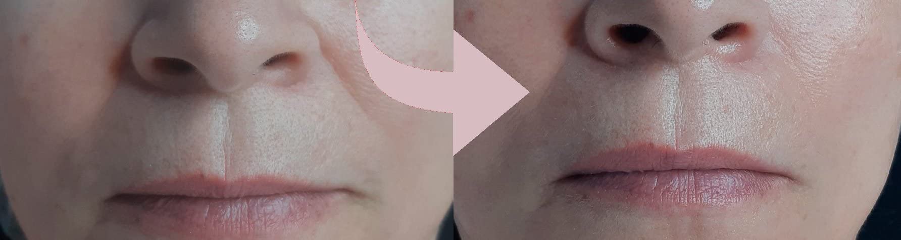 Casmara, krem do twarzy Infinity 50 ml - natychmiastowy efekt liftingu, odmładza dojrzałą skórę i zwalcza głębokie zmarszczki