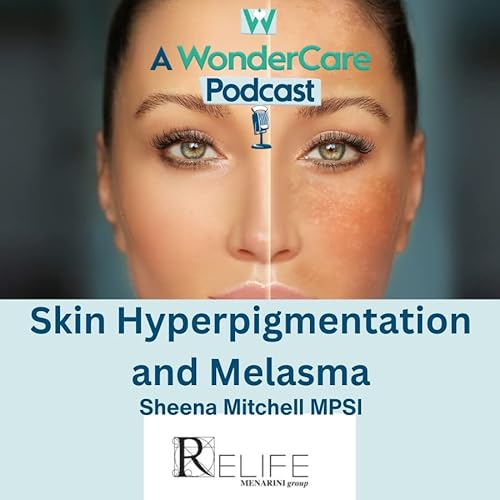 Skin Hyperpigmentation and Melasma Podcast Por  arte de portada