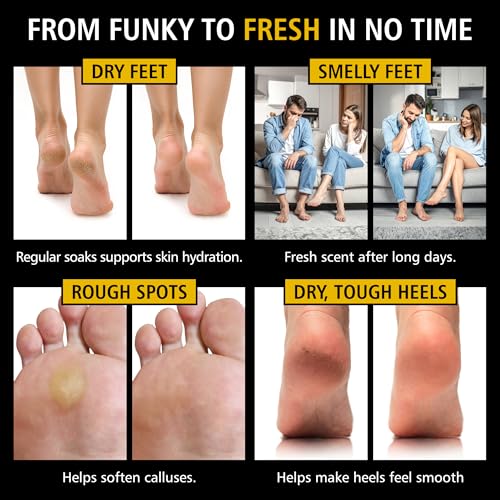 Image of Heavy Duty Tea Tree Oil Foot Soak - Epsom Salt for Soaking for Odor & Footbath to Soften Calluses - Athletes Foot - Nail Discoloration - Relaxing Pedicure Soak - Dry Skin & Rough Heels - 16oz