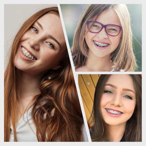 RTRTGS 10 Stück Kieferorthopädische Elastische Einweg-Kunststoff-Zahnspangenentfernungswerkzeuge Materialplatzierungs Elastischer Seilhaken Elastischer Haken