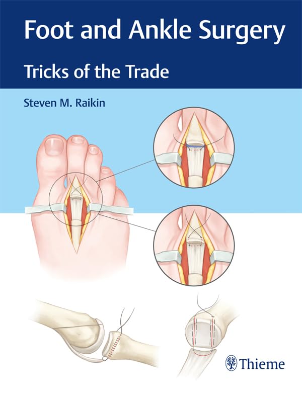 Foot and Ankle Surgery: Tricks of the Trade (English Edition)