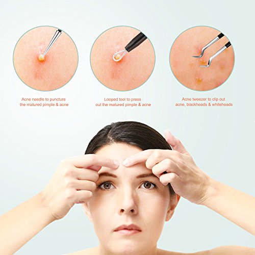 Blackhead Removal Tool, Pimple Comedone Extractor Tool Free Facial Tools for Facial Acne and Treatment for Blemish with Face Cleaner Skin Care & Stainless Steel - Thumbnail 6