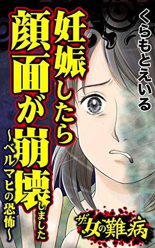 ザ 女の難病 妊娠したら顔面が崩壊しました ベルマヒの恐怖 私の人生を変えた女の難病vol 2 スキャンダラス レディース シリーズ くらもとえいる マンガ Kindleストア Amazon