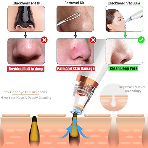 Image of 6-in-1 Deep Pore Cleaning Device with Strong Suction | Rechargeable Blackhead & Acne Remover Vacuum Tool | Facial Skin Care Machine for Nose, Oil Control & Smooth Clear Skin (White)