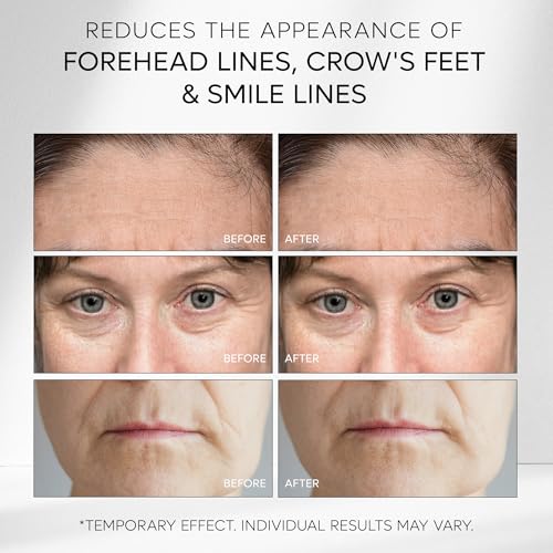 Creme Instant Rapid Face Lift: Aperto temporário para os olhos, removedor instantâneo de rugas para