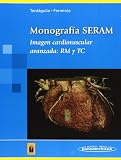  Monografía SERAM: Imagen cardiovascular avanzada: RM y TC (Tardáguila / Ferreirós)