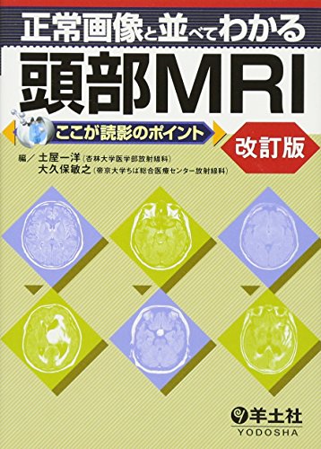 キンドル 無料電子書籍 正常画像と並べてわかる頭部MRI―ここが読影のポイント バイ