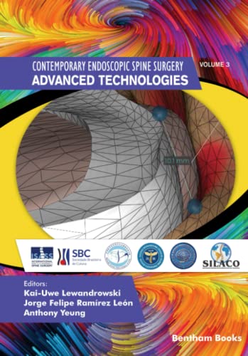 Advanced Technologies (Contemporary Endoscopic Spine Surgery)