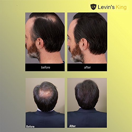 Tom Bull LK Levin's King ® Hair Building Fiber, Hair concealer Refill Pack Use For Caboki, Tom Bull, Toppik, Looks 21 etc.Black Color 25 Gram Pack of 1 - Image 3