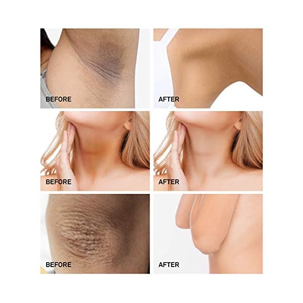 Natural-Vine-Underarm-Cream-Dark-Spot-Cream-Instant-Result-Brighten-Moisturizes-Armpit-Neck-Knees-Private-Parts60ML Natural Vine Underarm Cream, Dark Spot Cream, Instant Result, Moisturizes Armpit, Neck, Knees, Private Parts