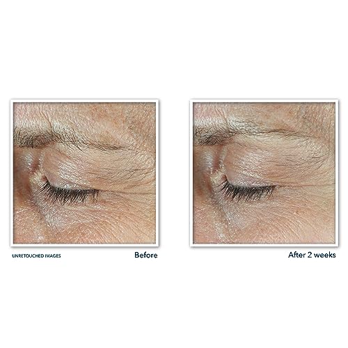 Roc 240137500 Derm Correxion Dual Eye Cream With Advanced Retinol + Peptides thumb #5
