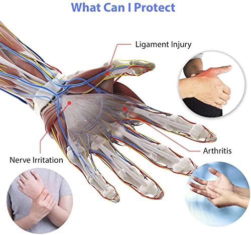 Image of MOMISY Arthritis Gloves