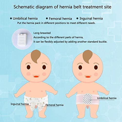 Faja para hernia umbilical para mujer y hombre miniatura 5