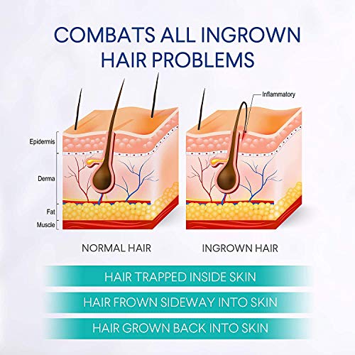 image for Evagloss Bumps Solution- After Shave Repair Serum for Ingrowns and Bur